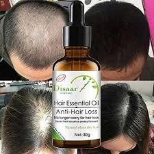🧴 Di adiós a la caída del cabello y saluda a una melena más fuerte 💪