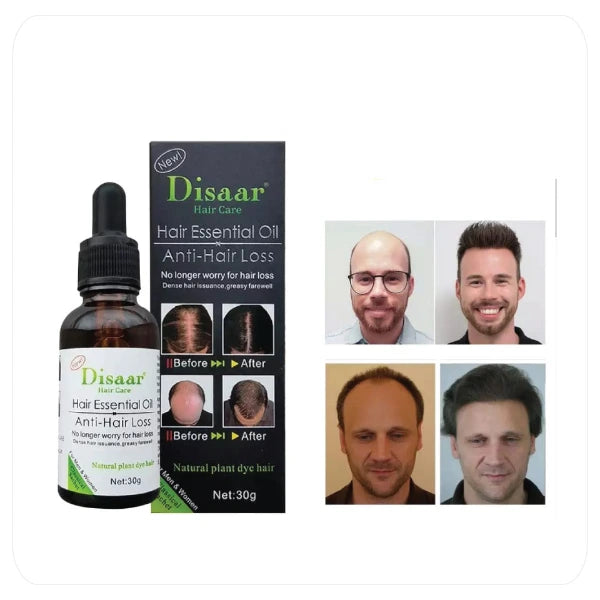 🧴 Di adiós a la caída del cabello y saluda a una melena más fuerte 💪